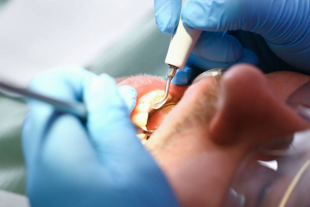 Best Broken or Cracked Tooth Emergency Dentist in East Cleveland, TN