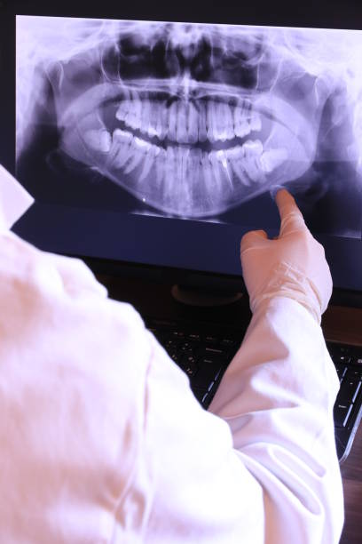 Best Emergency Dental Care for Abscessed Tooth in East Cleveland, TN